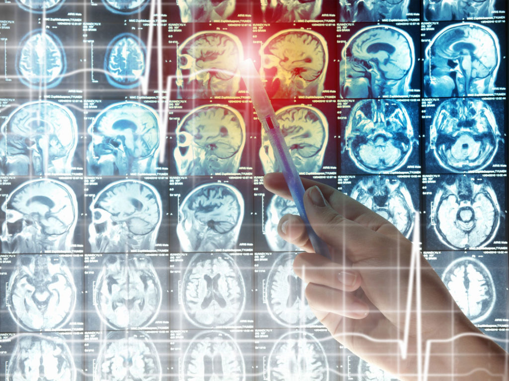 Molecular Imaging